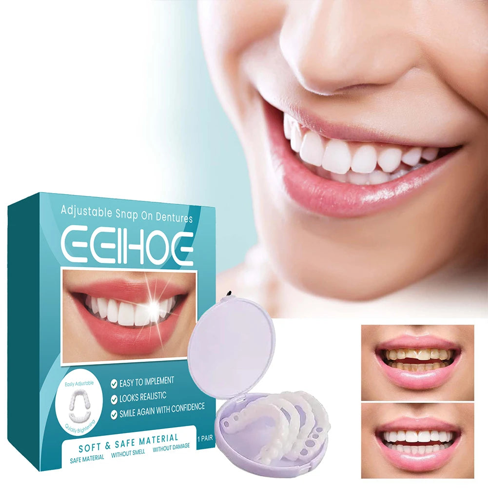 Instant Smile Veneers