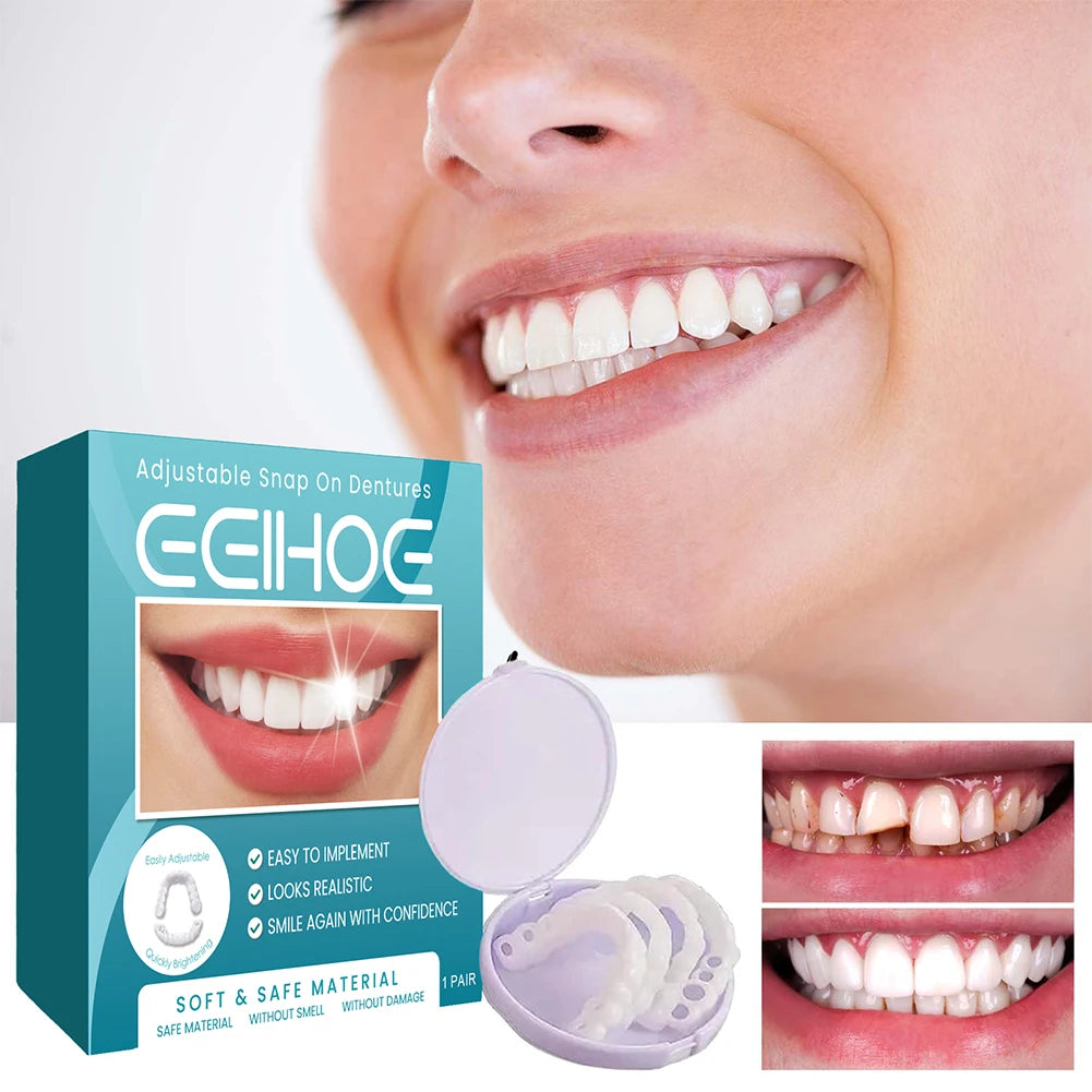 Instant Smile Veneers